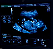 Ultraschallfoto von unserem Baby